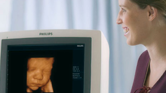 Ultraschallanlage fuer schwangere Frau