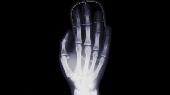 Röntgenbild einer Hand.
